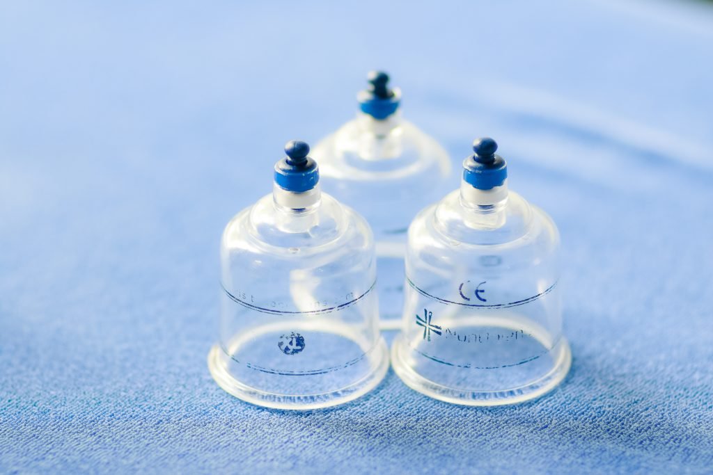 cupping-amsterdam-massage